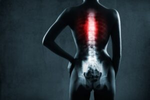 Types of Spinal Cord Injury Cases We Handle in Peachtree City